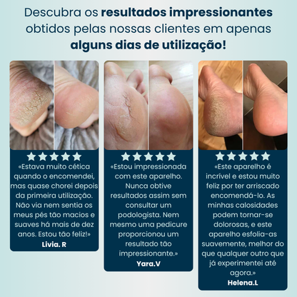 PéSuave™ Lixadeira Elétrica