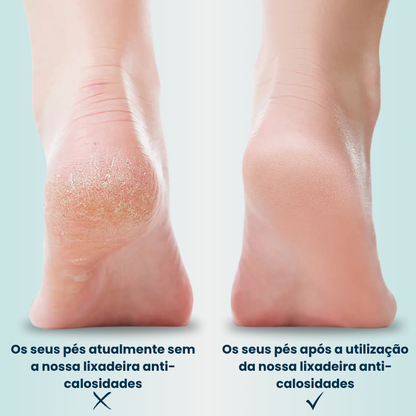 PéSuave™ Lixadeira Elétrica