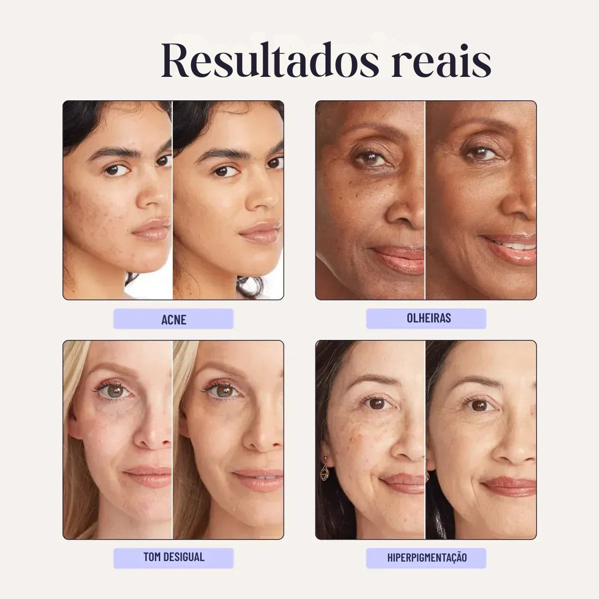 Supreme Cream Perfeicionador da Pele